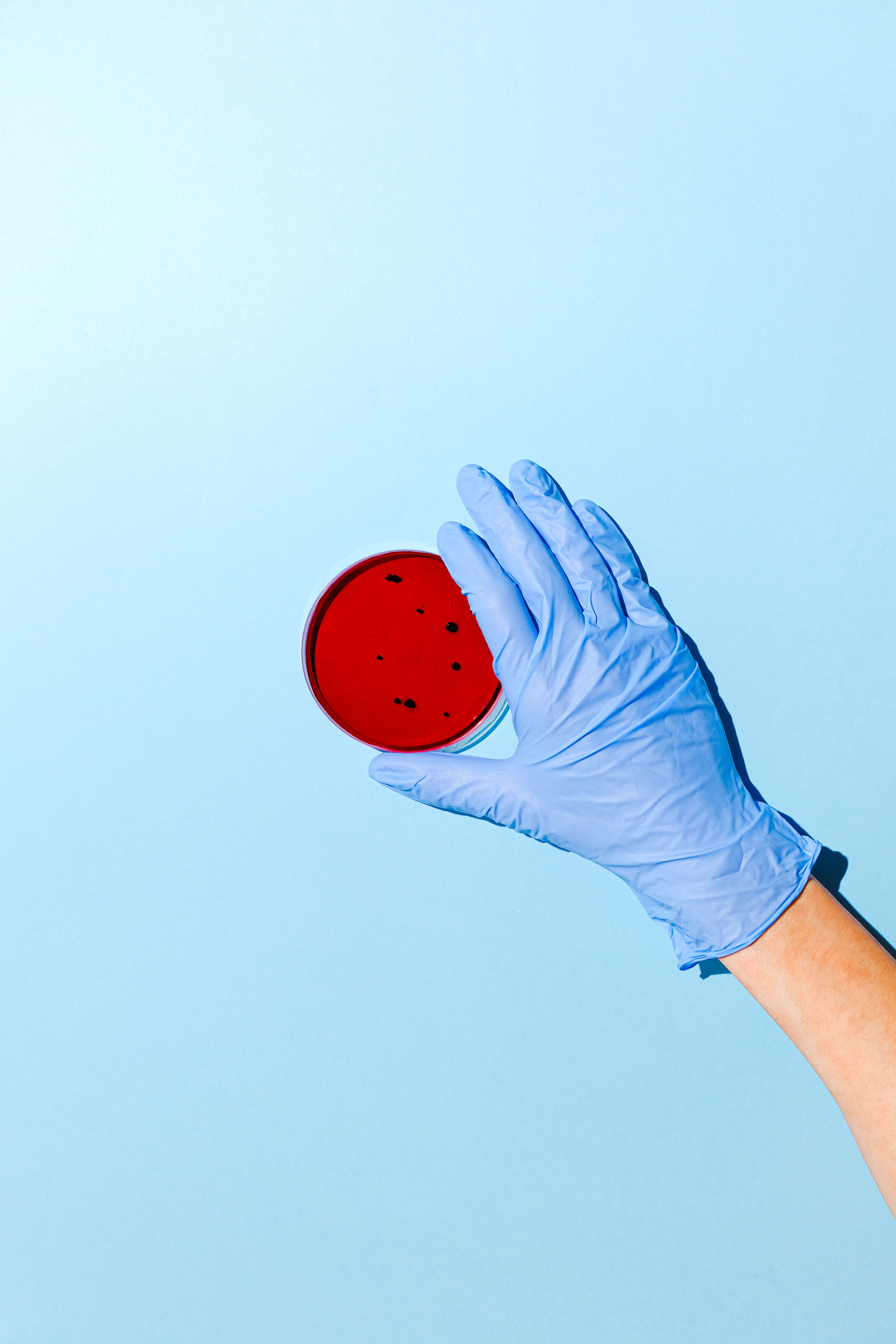 person-holding-red-petri-dish-3786210